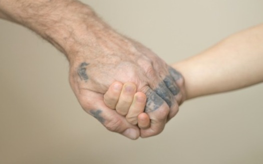 A patient gets his hand tattoo removed. (Adobe Stock)