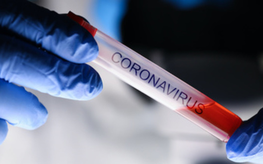 Hispanic and African-American populations in King County make up a disproportionate number of confirmed coronavirus cases. (H_Ko/Adobe Stock)