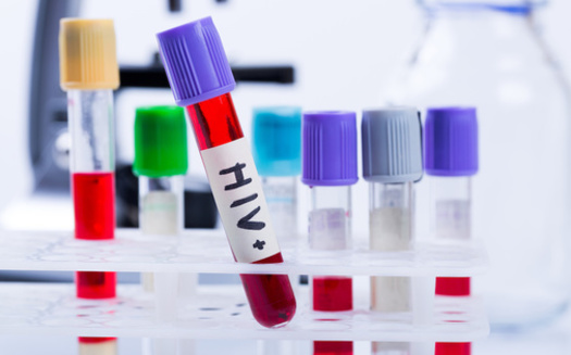 Sunday, June 27, is National HIV Testing Day. Healthcare experts urge people who are sexually active to get tested for HIV once every three months to stay up-to-date on your status. (ronstik/Adobe Stock)