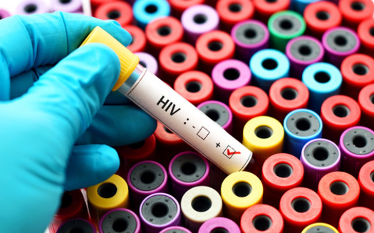 More than 4,500 Michiganders take PrEP, a HIV-prevention medication. (Adobe Stock)