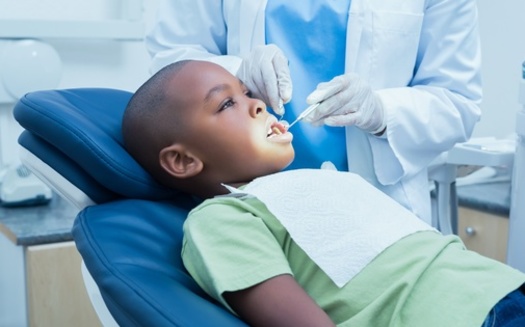 One in five children nationwide has at least one untreated cavity, according to data from the Centers for Disease Control and Prevention. (Adobe Stock)
