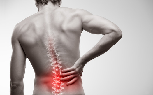 One in four Americans lives with lower back pain, according to the Centers for Disease Control and Prevention. (Adobe Stock)<br />