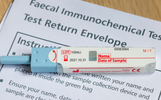 FIT tests to screen for colorectal cancers typically are received and sent through the mail. (Paul Maguire/Adobe Stock)
