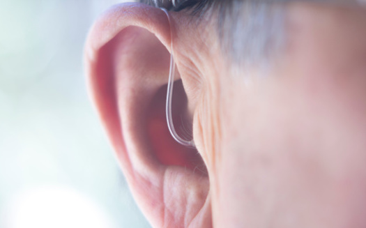 Approximately one-third of Americans age 65 to 74 have hearing loss, and that goes up to nearly half for those older than 75. (Edwardolive/Adobestock)