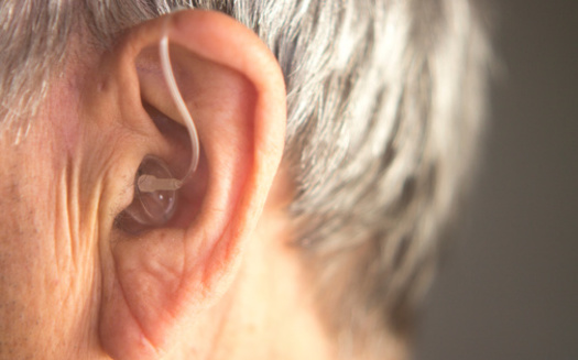 hearing aids are not covered under Medicare or most insurance plans. (EdwardOlive/Adobestock)