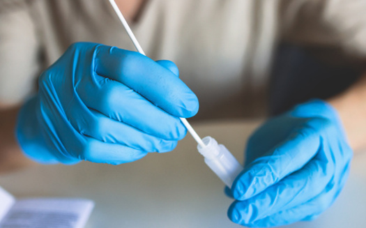 A temporary intellectual property waiver gave countries around the world better access to COVID-19 vaccines, but did not extend to treatments and tests. (tsuguliev/Adobe Stock)