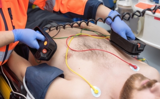 The CDC recommends schools, businesses and public gathering places keep an artificial external defibrillator available. (Adobe Stock)