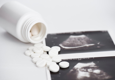 Peer-reviewed research on the use of misoprostol alone for abortion, published this month by the University of Texas at Austin, found it was 88% effective, with few serious adverse events or signs of complications. (ivanko80/AdobeStock)