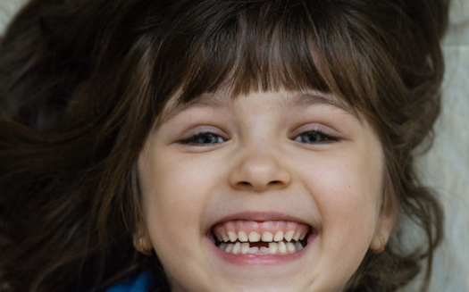 Children aged 5 to 19 from low-income families are twice as likely to have cavities, compared with children from higher-income households, according to the Centers for Disease Control and Prevention. (Adobe Stock)