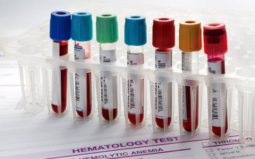 Cancer care costs are expected to top more than $245 billion by 2030, according to the American Association for Cancer Research. (Adobe Stock)