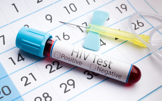 The Centers for Disease Control and Prevention finds declines in HIV/AIDS aren't even across all racial and ethnic groups. The lowest decline was 27% between 2017 and 2021 among young Black and African American gay and bisexual males ages 13 to 24. (Adobe Stock)