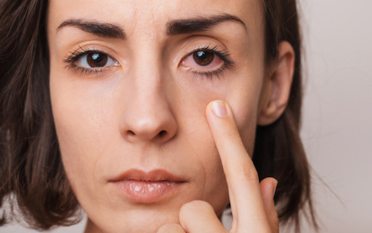 More than two dozen over-the-counter eyedrop products could be contaminated and should not be used by consumers, according to the U.S. Food and Drug Administration. (Adobe Stock)<br />