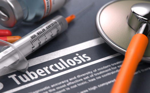 Researchers at the University of Montana are working on a vaccine for tuberculosis. While considered a serious problem in underdeveloped parts of the world, cases in the United States are up, having jumped to 8,300 in 2022 from 7,874 in 2021. (Adobe Stock)