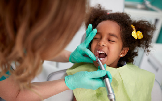 Studies indicate that fluoride varnish can prevent about one-third of cavities in baby teeth. (Lucky Business/Adobestock)