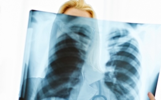 An estimated 16% of coal workers are affected by black lung disease and after decades of improvement, the number of cases of the disease is on the rise again, according to the American Lung Association. (Adobe Stock).<br />