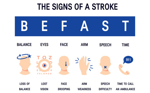 If symptoms of stroke are recognized within the first four and a half hours, experts said irreversible damage can be prevented. (marina_ua/Adobe Stock)