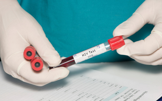 People with HIV who know their status, take HIV medicine as prescribed, and get and keep an undetectable viral load can live long and healthy lives. (Adobe Stock) 