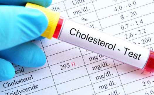 A blood test is the only way to determine your cholesterol levels.  (jarun011/Adobe Stock)