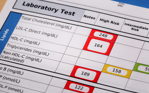 A blood test is the only way to determine your cholesterol levels. (jarun011/Adobe Stock)