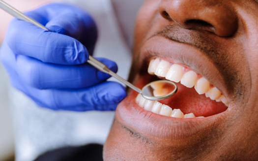 West Virginia is a designated Health Professional Shortage Area for dental providers, falling short by 135 dentists statewide, according to the health care advocacy group KFF. (Adobe Stock) 