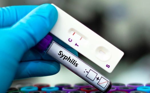 According to the Great Plains Tribal Epidemiology Center, one in 40 Native American and Alaska Native babies born in the Great Plains region in 2022 had a syphilis infection. (Adobe Stock)