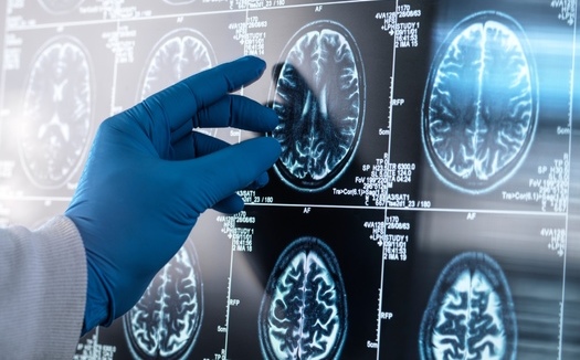 Dementia is the third-largest cause of death for individuals age 70 and older in the United States. (Adobe Stock)