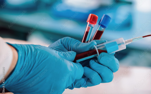 A 2021 U.S. Government Accountability Office study estimated there are 7,000 to 8,000 ailments recognized as rare diseases that affect around 30 million people in the United States. (Adobe Stock)