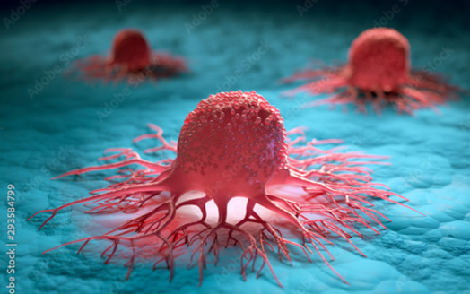 A study from the Indiana Cancer Control Plan found two in five Hoosiers now living will eventually have cancer. (Adobe Stock)