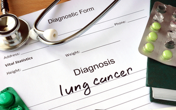Lung cancer kills more than 400 people every day, according to the American Lung Association. (designer491/iStockPhoto)